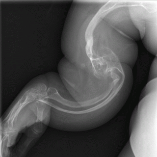 041. 闲聊《醉茶志怪》| 第二集: 庭院朽木之谜与人面疮的诡异传说